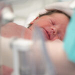 A premature baby receiving care: