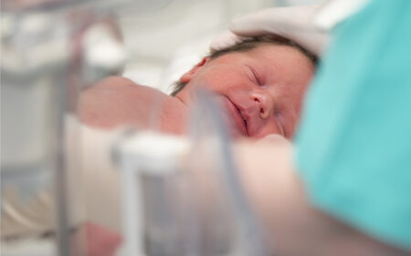 A premature baby receiving care: