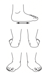 Figure 2. Flat feet appear flat with no arch
